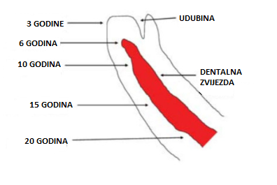 dent zvijezda i udubina